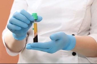 Platelet-Rich Plasma Therapy (PRP) With Dr. Jones | CSOG