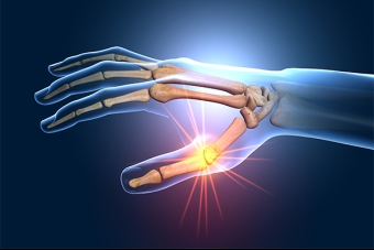 The Link Between BMI and Joint Health: How Weight Impacts Hip and Knee Joint Longevity