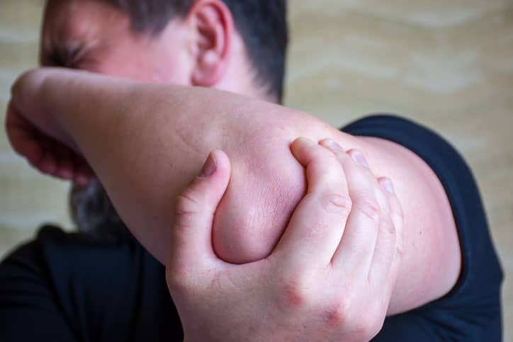 Man suffering from cubital tunnel syndrome holding his elbow in pain