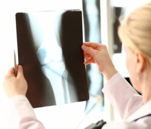 Female radiologist holding an Xray of a possible meniscus injury. 