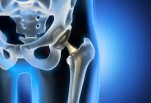 Hip Labral Repair vs Hip Reconstruction