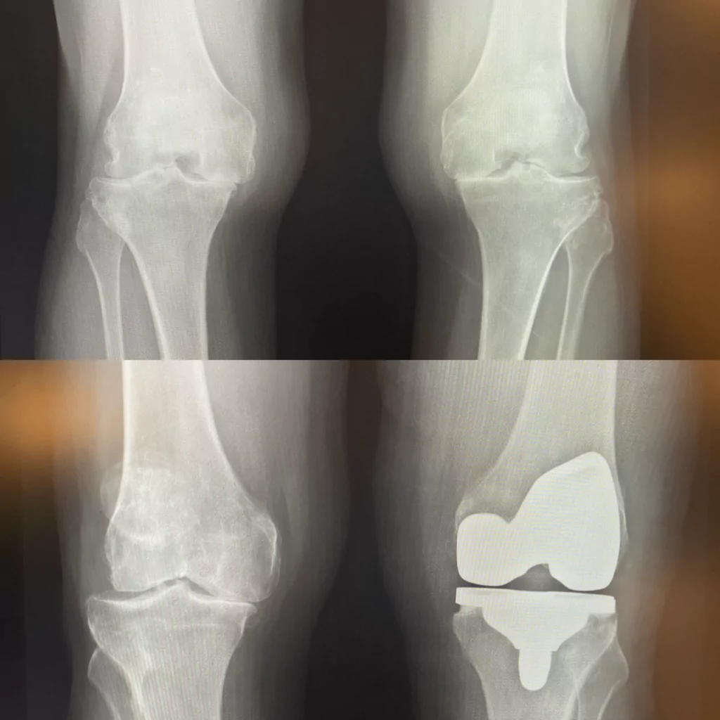 20+ Dexa Scan Colorado Springs