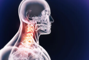 Neck Pain