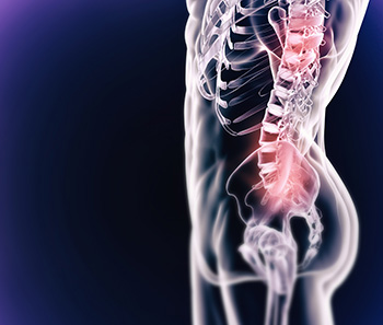 Colorado Spine Specialists Spine Care Conditions and Injuries such as low back pain treated by the spine doctors in the CSOG spine center