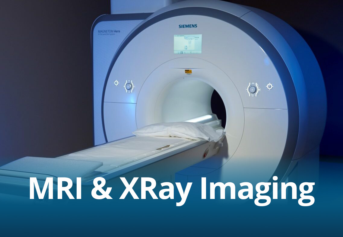 MRI